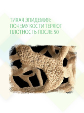 Тихая эпидемия: почему кости теряют плотность после 50